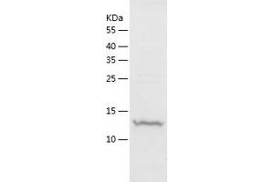 Western Blotting (WB) image for Stathmin 1 (STMN1) (AA 1-149) protein (His tag) (ABIN7125211)