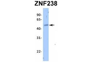 Host:  Rabbit  Target Name:  ZNF238  Sample Type:  Human Fetal Heart  Antibody Dilution:  1. (ZNF238 Antikörper  (N-Term))