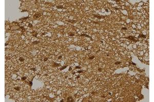 ABIN6262239 and ABIN6277597 at 1/100 staining Mouse brain tissue by IHC-P.