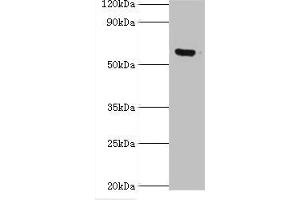 Western blot All lanes: MKS1 antibody at 6 μg/mL + Hela whole cell lysate Secondary Goat polyclonal to rabbit IgG at 1/10000 dilution Predicted band size: 65, 60, 64 kDa Observed band size: 65 kDa (MKS1 Antikörper  (AA 150-300))