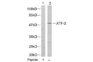 Image no. 2 for anti-Activating Transcription Factor 2 (ATF2) (Thr55), (Thr73) antibody (ABIN197150) (ATF2 Antikörper  (Thr55, Thr73))