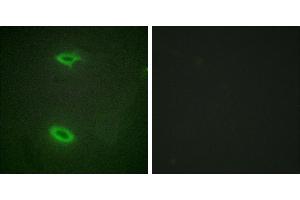 Peptide - +Western blot analysis of extracts from HepG2 cells, using DLGP1 antibody.