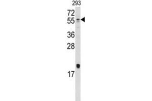 Western Blotting (WB) image for anti-Bone Morphogenetic Protein 10 (BMP10) antibody (ABIN5018806) (BMP10 Antikörper)