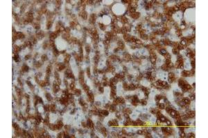 Image no. 2 for anti-Keratin 18 (KRT18) (AA 1-431) antibody (ABIN598778) (Cytokeratin 18 Antikörper  (AA 1-431))