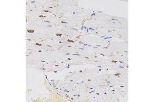 Immunohistochemistry of paraffin-embedded rat heart using FAF1 antibody (ABIN5975642) (40x lens). (FAF1 Antikörper)
