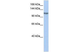 WB Suggested Anti-TGS1 Antibody Titration:  0. (TGS1 Antikörper  (Middle Region))