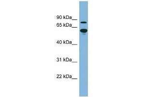 ABCF2 antibody used at 1 ug/ml to detect target protein. (ABCF2 Antikörper)
