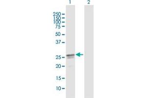 Western Blot analysis of C17orf66 expression in transfected 293T cell line by C17orf66 MaxPab polyclonal antibody. (C17orf66 Antikörper  (AA 1-219))