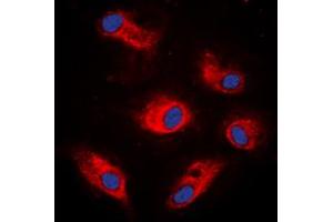 Immunofluorescent analysis of S6K1 (pS434) staining in K562 cells. (RPS6KB1 Antikörper  (C-Term, pSer434))