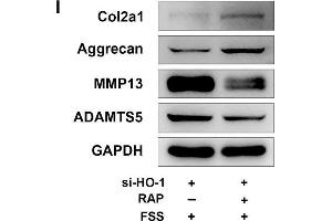 Rapamycin regulates autophagy and ECM in NP cells. (COL2A1 Antikörper  (AA 873-1072))