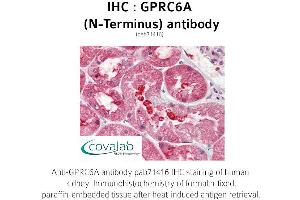 Image no. 1 for anti-G Protein-Coupled Receptor, Family C, Group 6, Member A (GPRC6A) (Extracellular Domain), (N-Term) antibody (ABIN1735226) (GPRC6A Antikörper  (Extracellular Domain, N-Term))