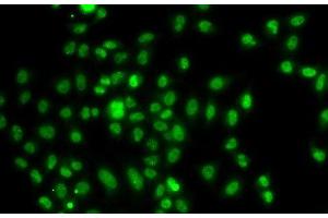 Immunofluorescence analysis of A549 cells using FOXN2 Polyclonal Antibody (FOXN2 Antikörper)