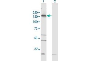 Western Blot analysis of TBC1D1 expression in transfected 293T cell line by TBC1D1 MaxPab polyclonal antibody. (TBC1D1 Antikörper  (AA 1-1168))