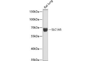 Western blot analysis of extracts of rat lung, using SLC1 antibody (ABIN6128765, ABIN6147874, ABIN6147876 and ABIN6216404) at 1:1000 dilution. (SLC1A5 Antikörper  (AA 1-100))
