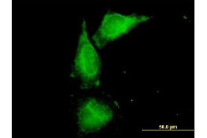 Immunofluorescence of purified MaxPab antibody to UMOD on HeLa cell. (Uromodulin Antikörper  (AA 1-611))