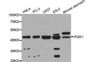 Western blot analysis of extracts of various cell lines, using PGK1 antibody (ABIN5971017) at 1/1000 dilution. (PGK1 Antikörper)