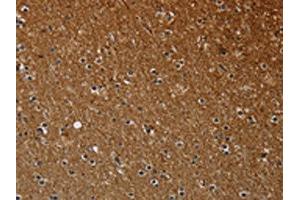 The image on the left is immunohistochemistry of paraffin-embedded Human brain tissue using ABIN7191586(NCKAP1 Antibody) at dilution 1/30, on the right is treated with synthetic peptide. (NCKAP1 Antikörper)