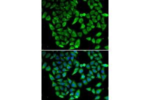 Immunofluorescence analysis of HeLa cells using ASIP antibody. (ASIP Antikörper)