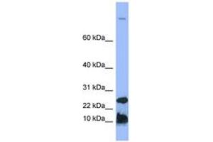 Image no. 1 for anti-Hepcidin Antimicrobial Peptide (HAMP) (N-Term) antibody (ABIN6741742) (Hepcidin Antikörper  (N-Term))
