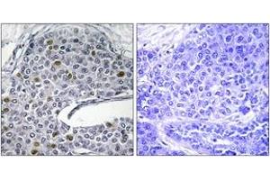 Immunohistochemistry (IHC) image for anti-Interferon Regulatory Factor 3 (IRF3) (AA 351-400) antibody (ABIN2888668) (IRF3 Antikörper  (AA 351-400))