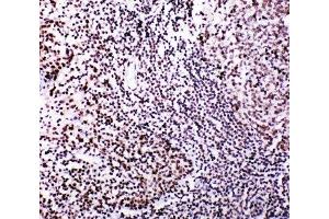 IHC-P: MYBL2 antibody testing of human tonsil tissue