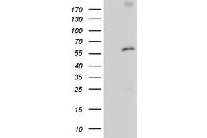 HEK293T cells were transfected with the pCMV6-ENTRY control (Left lane) or pCMV6-ENTRY PSMD3 (Right lane) cDNA for 48 hrs and lysed. (PSMD3 Antikörper)