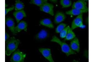 Detection of CAP3 in Human Hela Cell using Polyclonal Antibody to Cytoplasmic Antiproteinase 3 (CAP3)