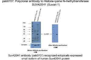 Image no. 1 for anti-Suppressor of Variegation 4-20 Homolog 1 (SUV420H1) antibody (ABIN1735481)