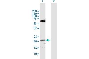 Western Blot analysis of CFC1 expression in transfected 293T cell line by CFC1 MaxPab polyclonal antibody.