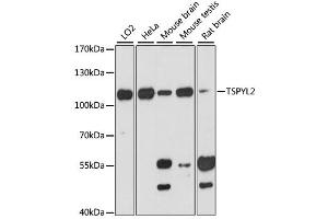 Western blot analysis of extracts of various cell lines, using TSPYL2 antibody (ABIN6291999) at 1:3000 dilution. (TSPY-Like 2 Antikörper)