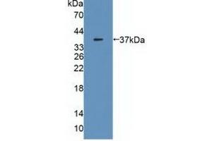 Detection of Recombinant MDH2, Human using Polyclonal Antibody to Malate Dehydrogenase 2 (MDH2) (MDH2 Antikörper  (AA 25-338))