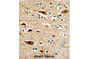 Formalin-fixed and paraffin-embedded human brainreacted with APP polyclonal antibody , which was peroxidase-conjugated to the secondary antibody, followed by AEC staining.