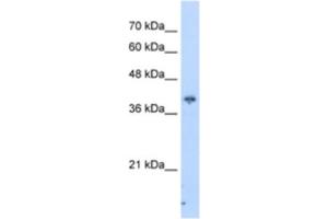 Western Blotting (WB) image for anti-Interaction Protein For Cytohesin Exchange Factors 1 (IPCEF1) antibody (ABIN2462961)