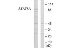 Western Blotting (WB) image for anti-Signal Transducer and Activator of Transcription 5A (STAT5A) (AA 386-435) antibody (ABIN2889477) (STAT5A Antikörper  (AA 386-435))