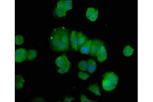 Immunofluorescence staining of MCF-7 cells with ABIN7150235 at 1:100, counter-stained with DAPI. (POLD3 Antikörper  (AA 203-275))