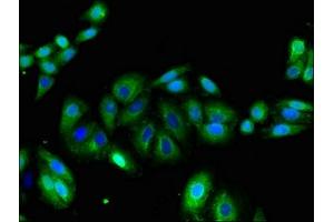 Immunofluorescent analysis of HepG2 cells using ABIN7163948 at dilution of 1:100 and Alexa Fluor 488-congugated AffiniPure Goat Anti-Rabbit IgG(H+L)