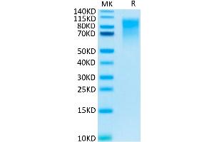 CEACAM1 Protein (His tag)