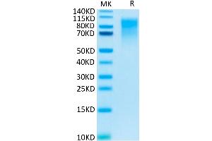 Human CEACAM-1 on Tris-Bis PAGE under reduced condition. (CEACAM1 Protein (His tag))