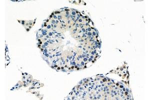 ABIN6260361 and ABIN6266793 at 1/100 staining Mouse testis tissue by IHC-P. (C1orf57 Antikörper  (C-Term))