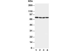 Western blot testing of IRAK1 antibody and Lane 1:  rat liver;  2: human placenta;  3: MCF-7;  4: PANC cell lysate