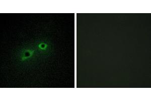 Peptide - +Immunohistochemistry analysis of paraffin-embedded human breast carcinoma tissue, using ENTK antibody. (TMPRSS15 Antikörper)