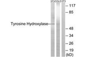 Western blot analysis of extracts from NIH-3T3/COLO cells, treated with Forskolin 40nM 30', using Tyrosine Hydroxylase (Ab-19) Antibody. (Tyrosine Hydroxylase Antikörper  (AA 10-59))