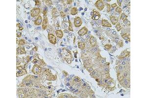 Immunohistochemistry of paraffin-embedded Human stomach using TRPA1 Polyclonal Antibody at dilution of 1:100 (40x lens). (TRPA1 Antikörper)