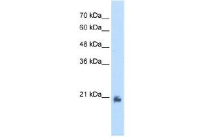 WB Suggested Anti-METTL7A Antibody Titration:  2. (METTL7A Antikörper  (N-Term))