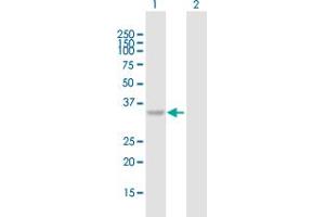 Western Blot analysis of C10orf46 expression in transfected 293T cell line by C10orf46 MaxPab polyclonal antibody. (CACUL1 Antikörper  (AA 1-303))