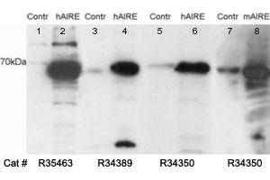 Western blot testing of untransfected (lane 1) and transfected (lane 2) HEK293 cell lysates with AIRE antibody at 0. (AIRE Antikörper)