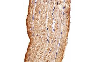Immunohistochemical analysis of paraffin-embedded H. (MAP4K3 Antikörper)