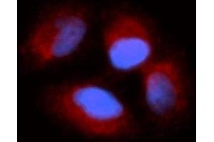 Immunofluorescence (IF) image for anti-Cyclin I (CCNI) (AA 1-377) antibody (PE) (ABIN5565347) (Cyclin I Antikörper  (AA 1-377) (PE))
