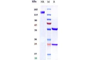 Anti-Ly6E Reference Antibody (RG7841) on SDS-PAGE under reducing (R) condition.