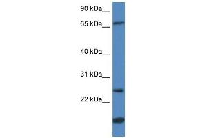 GSTM5 antibody used at 1 ug/ml to detect target protein. (GSTM5 Antikörper  (N-Term))